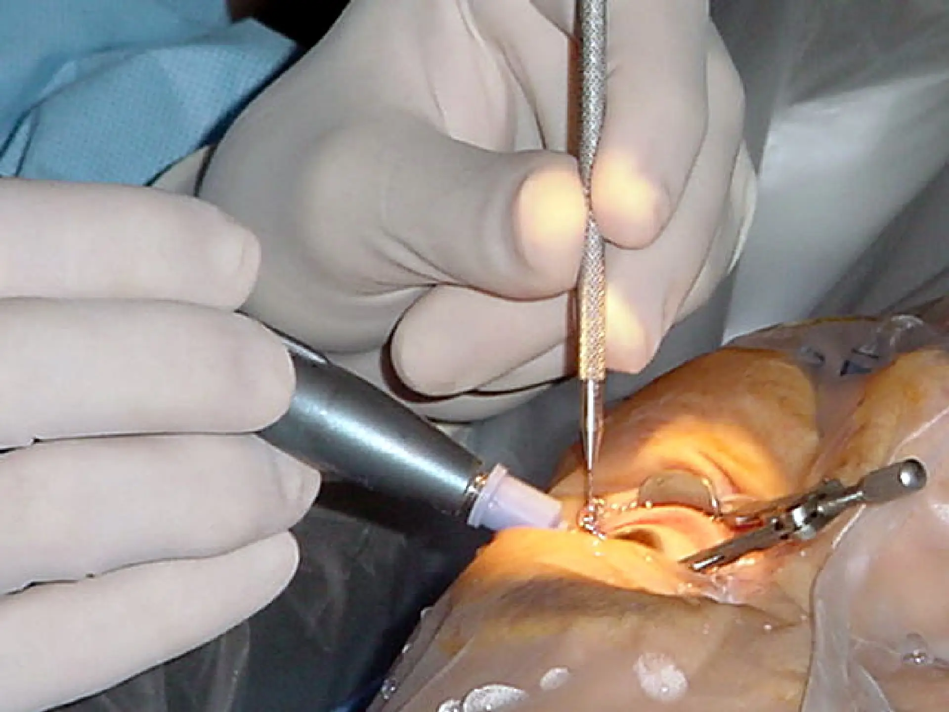 Vision Treatment